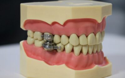 Researchers Trial Magnetic ‘Lockjaw’ against Obesity