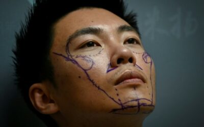 Men in China Go under the Knife to Boost Life Chances