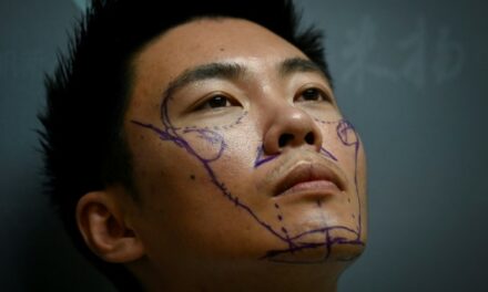 Men in China Go under the Knife to Boost Life Chances